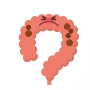 便秘が太る原因